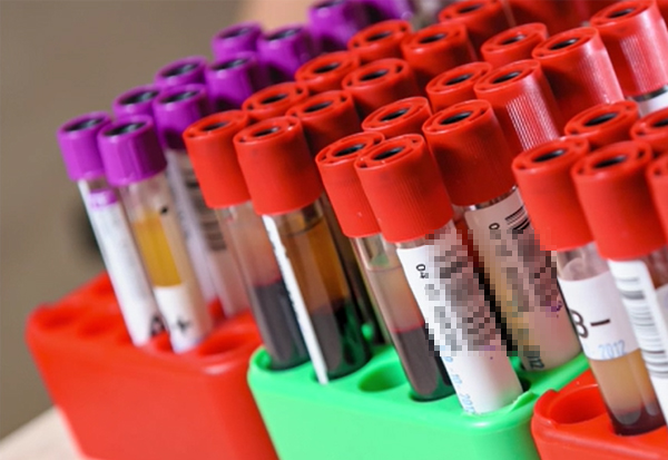 健康科普 | 抽血注意事項